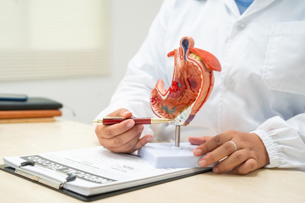 A female doctor a hospital desk discussing digestive disorders such as stomach ulcers,acid reflux